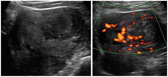 Diagnostics 12 01348 g0a7 550