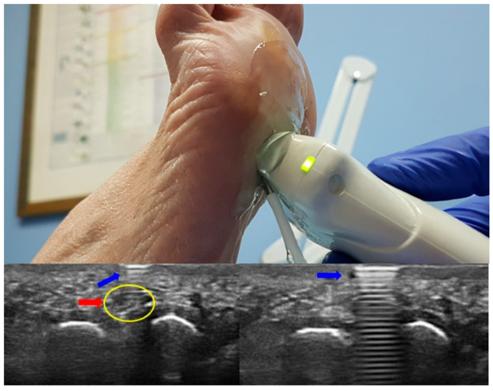 Diagnostics 12 01367 g002