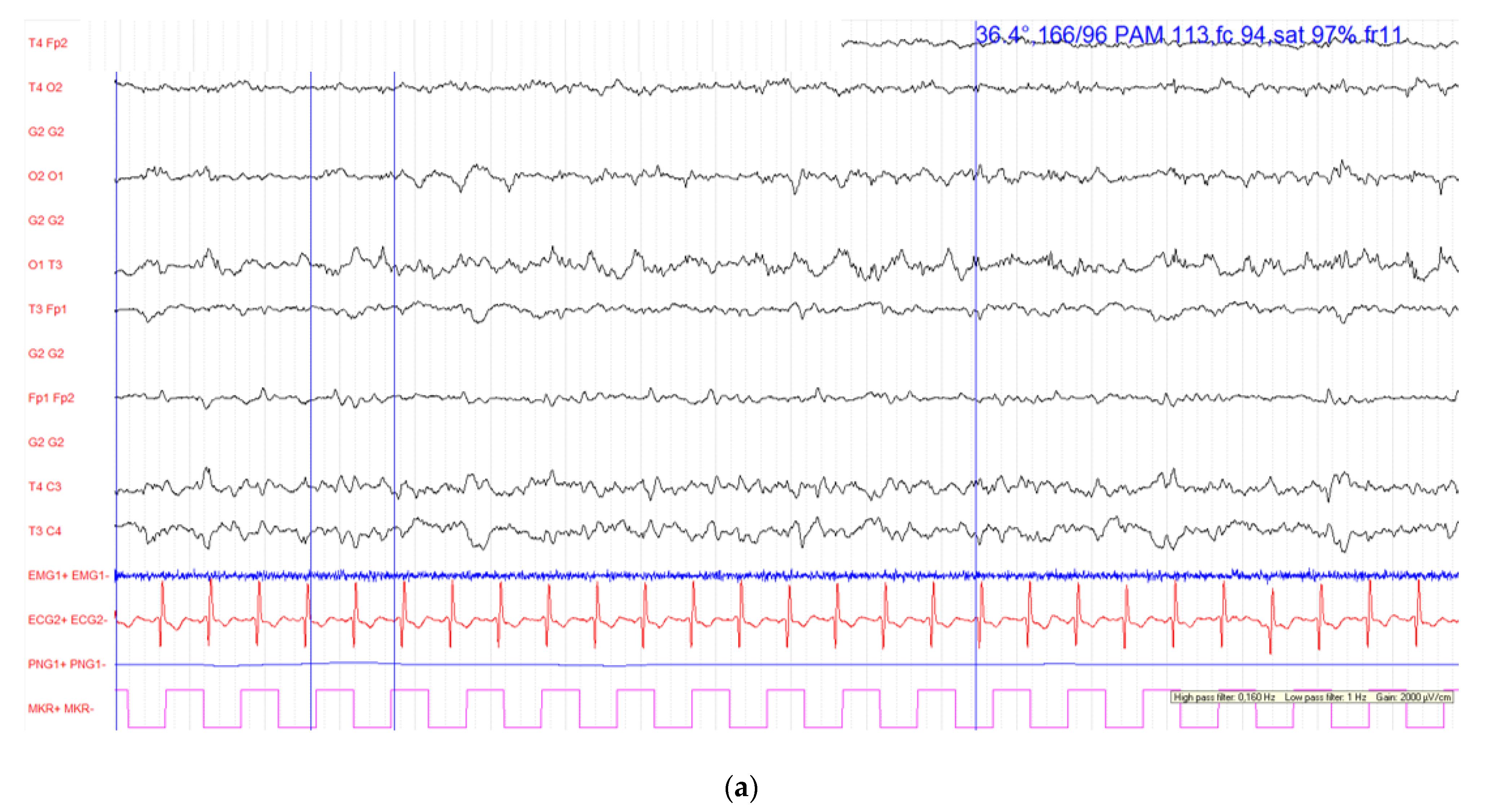 Diagnostics 12 01369 g001a