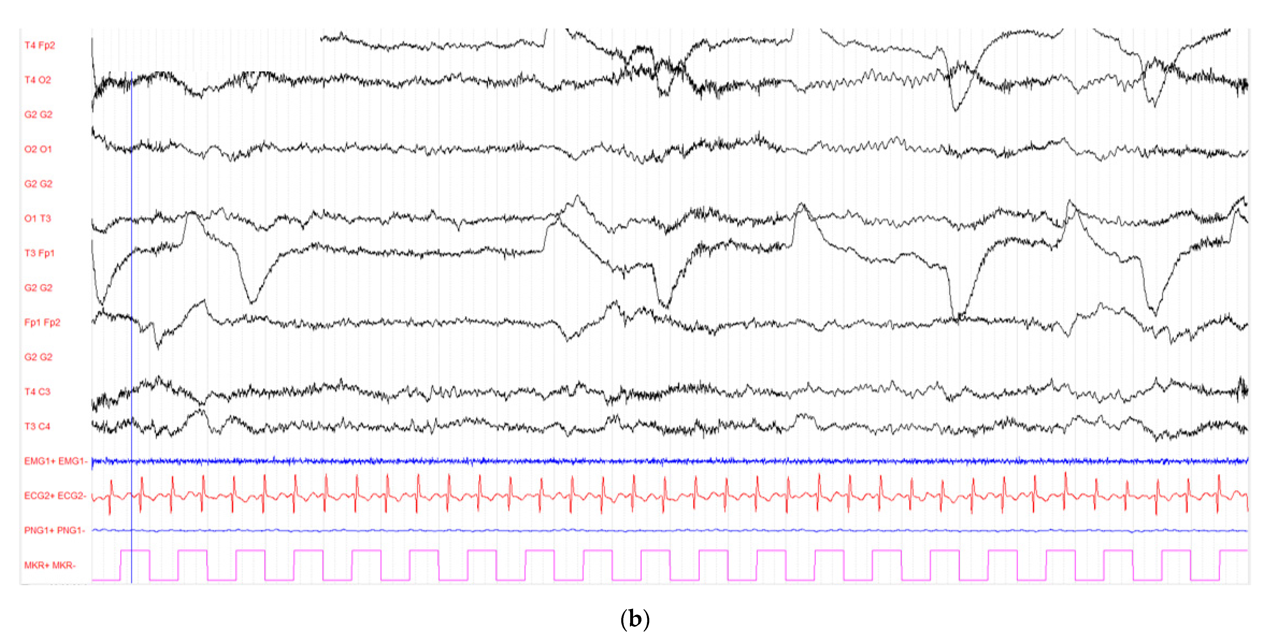 Diagnostics 12 01369 g001b