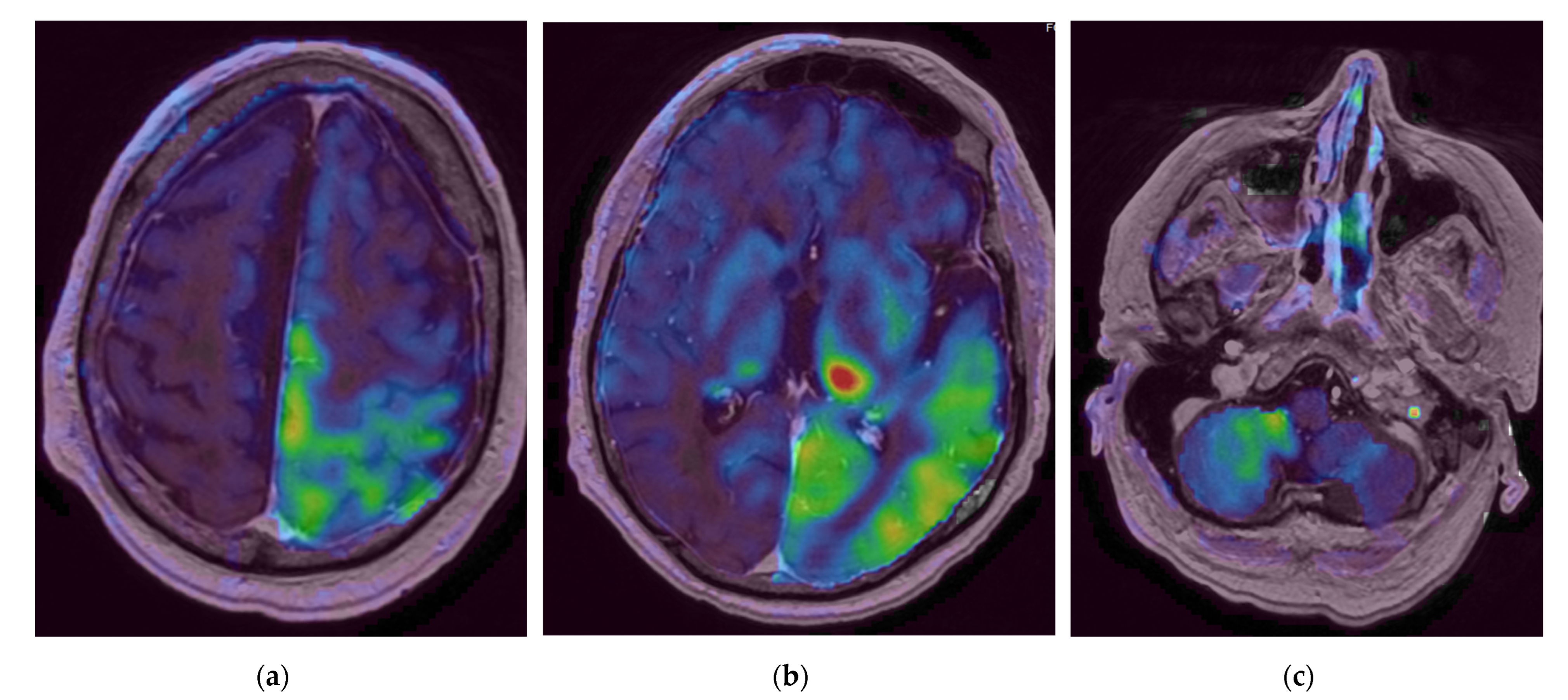 Diagnostics 12 01369 g004