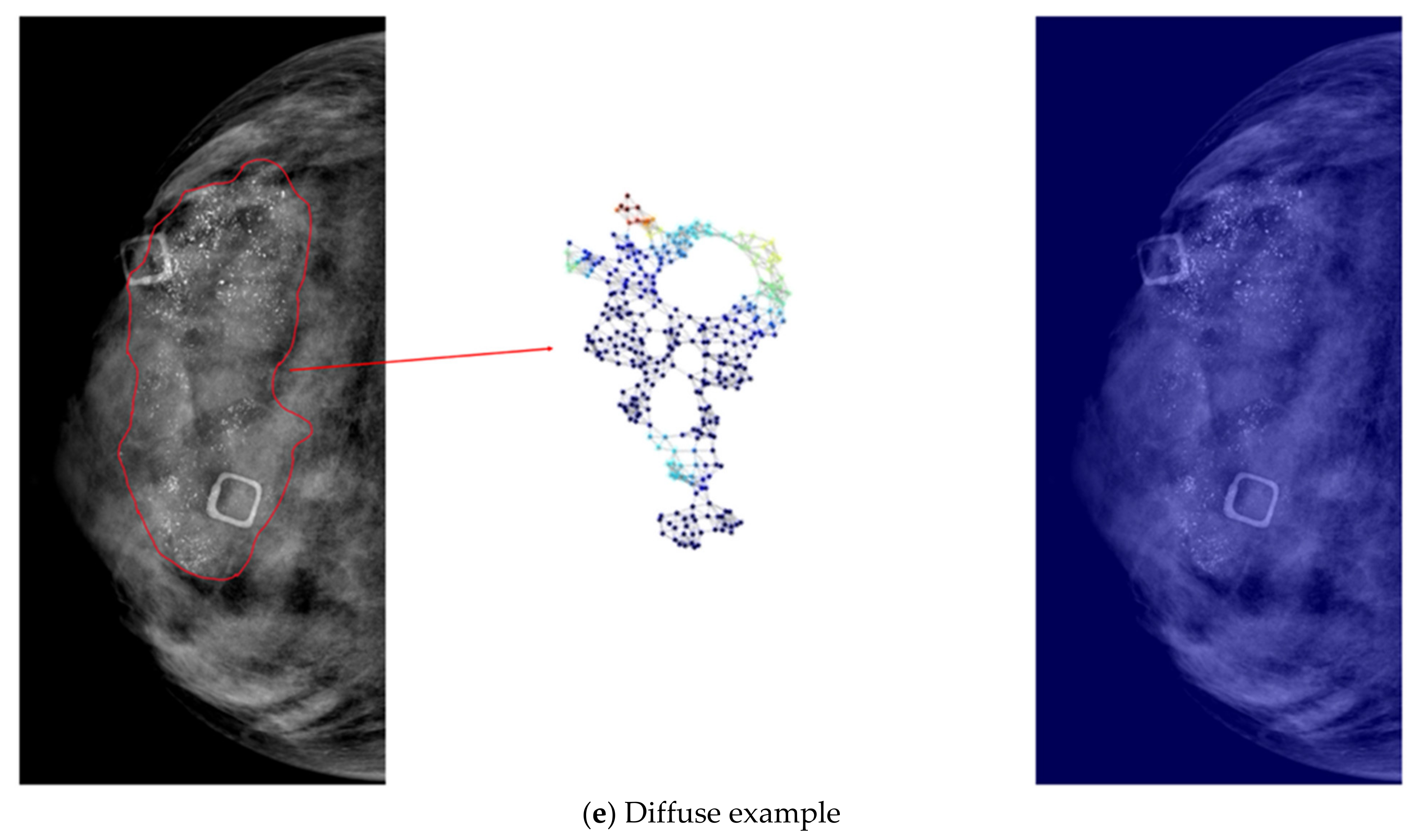 Diagnostics 12 01376 g005c