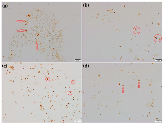 Diagnostics 12 01394 g002