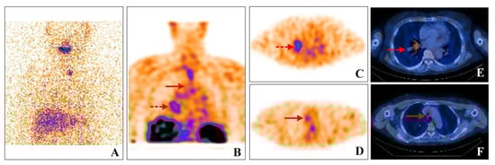 Diagnostics 12 01419 g001 550