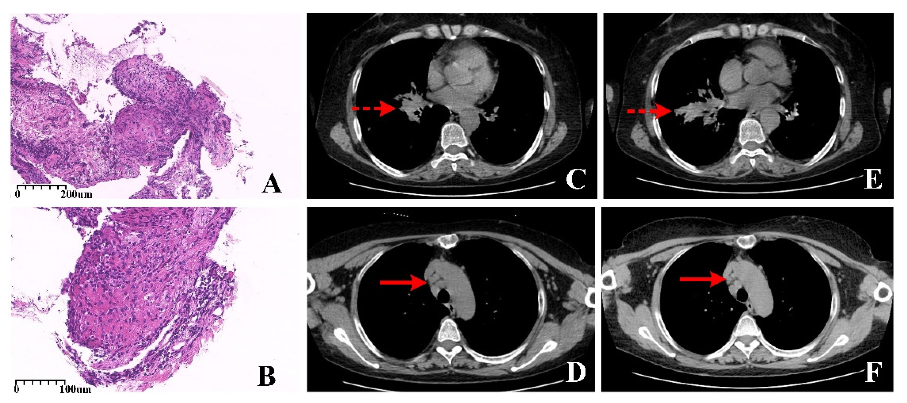 Diagnostics 12 01419 g002