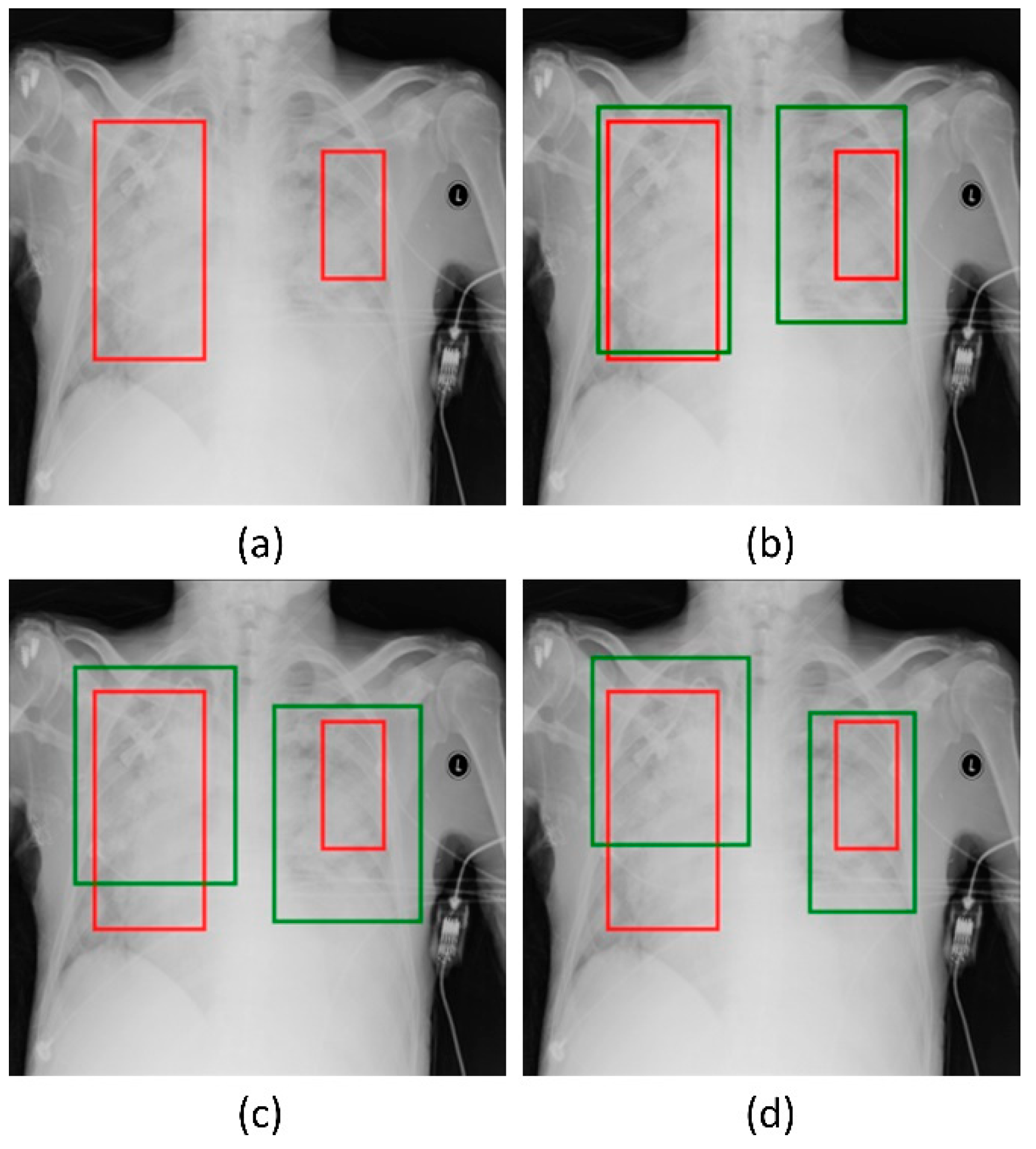 Diagnostics 12 01442 g006