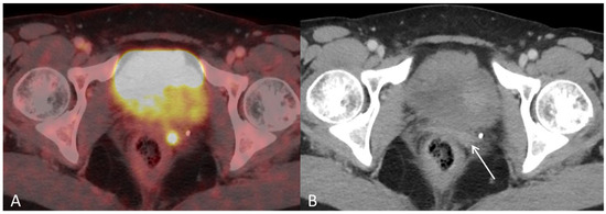 Diagnostics 12 01447 g003 550