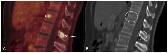 Diagnostics 12 01447 g006 550