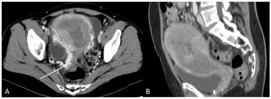 Diagnostics 12 01447 g007 550