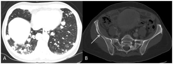 Diagnostics 12 01447 g008 550