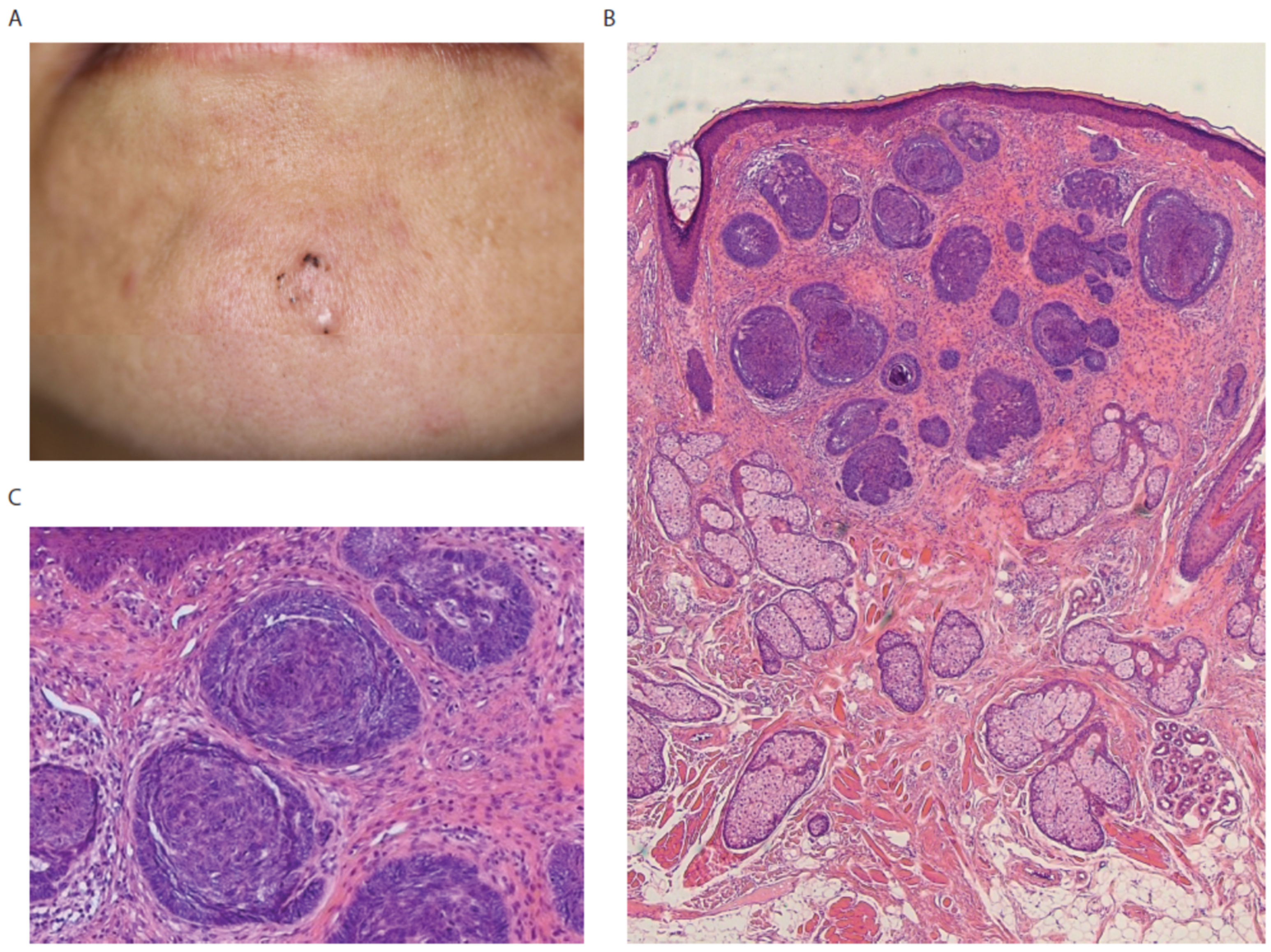 Diagnostics 12 01448 g001