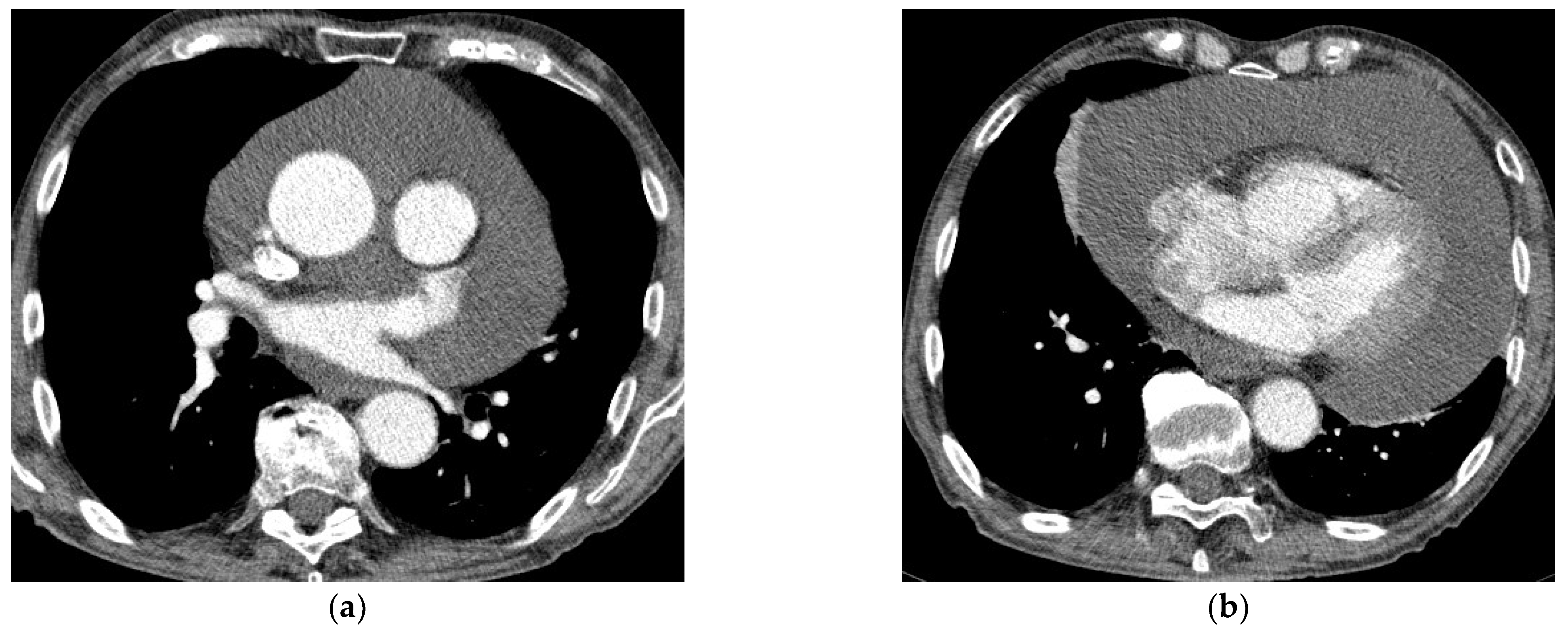 Diagnostics 12 01453 g002