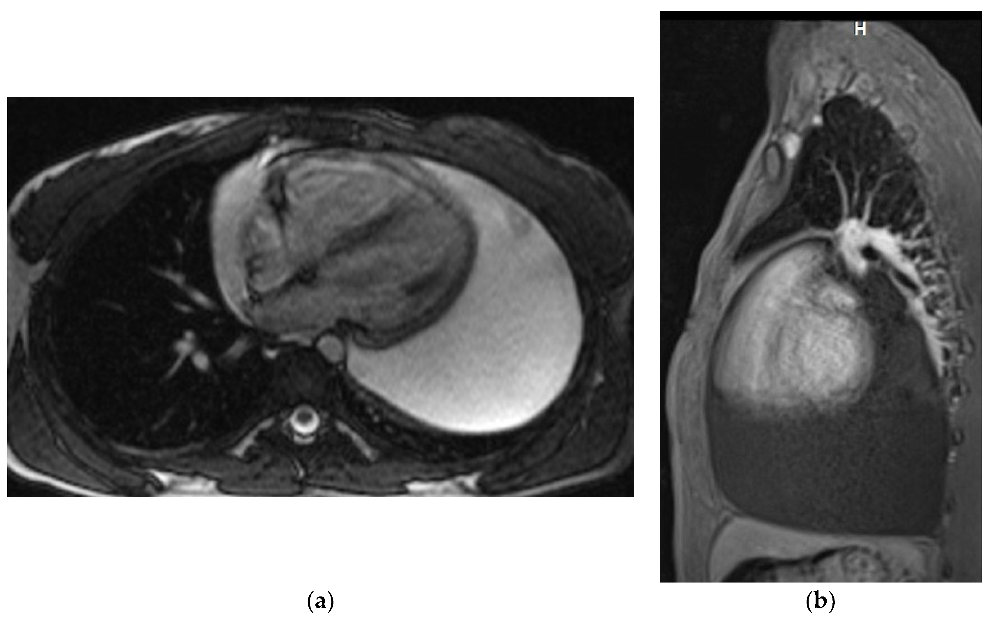 Diagnostics 12 01453 g003