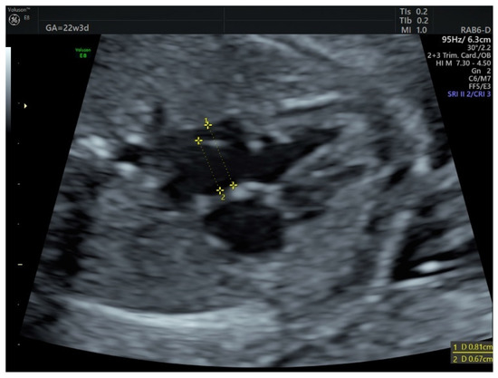 Diagnostics 12 01469 g001 550