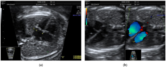 Diagnostics 12 01469 g002a 550
