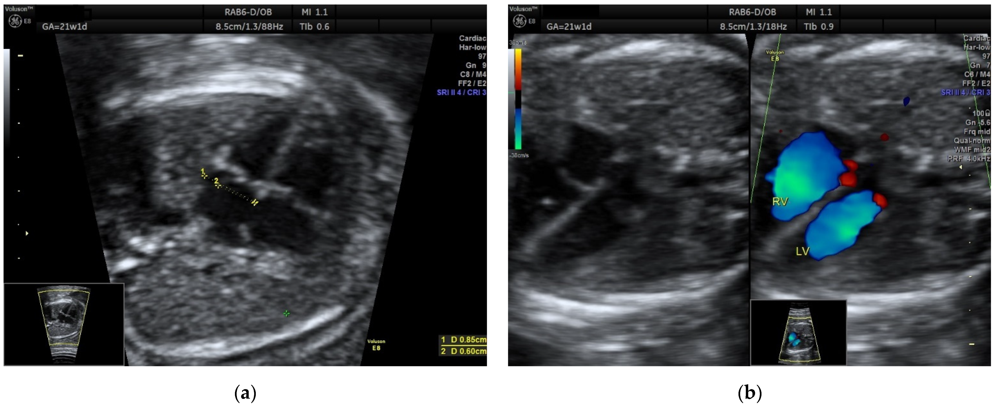 Diagnostics 12 01469 g002a