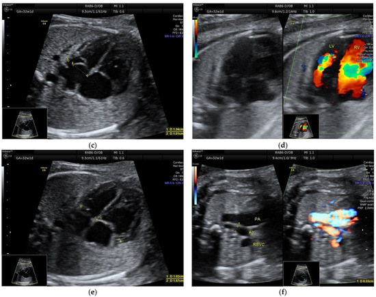 Diagnostics 12 01469 g002b 550