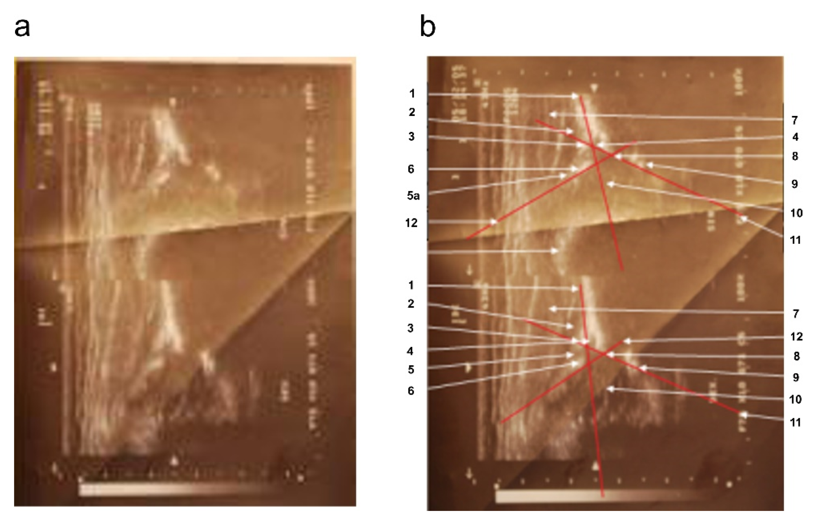 Diagnostics 12 01472 g002