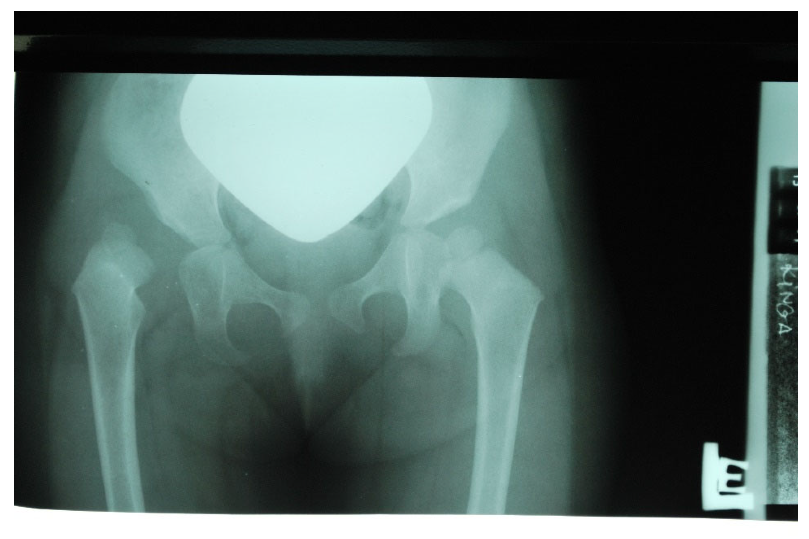 Diagnostics 12 01472 g003