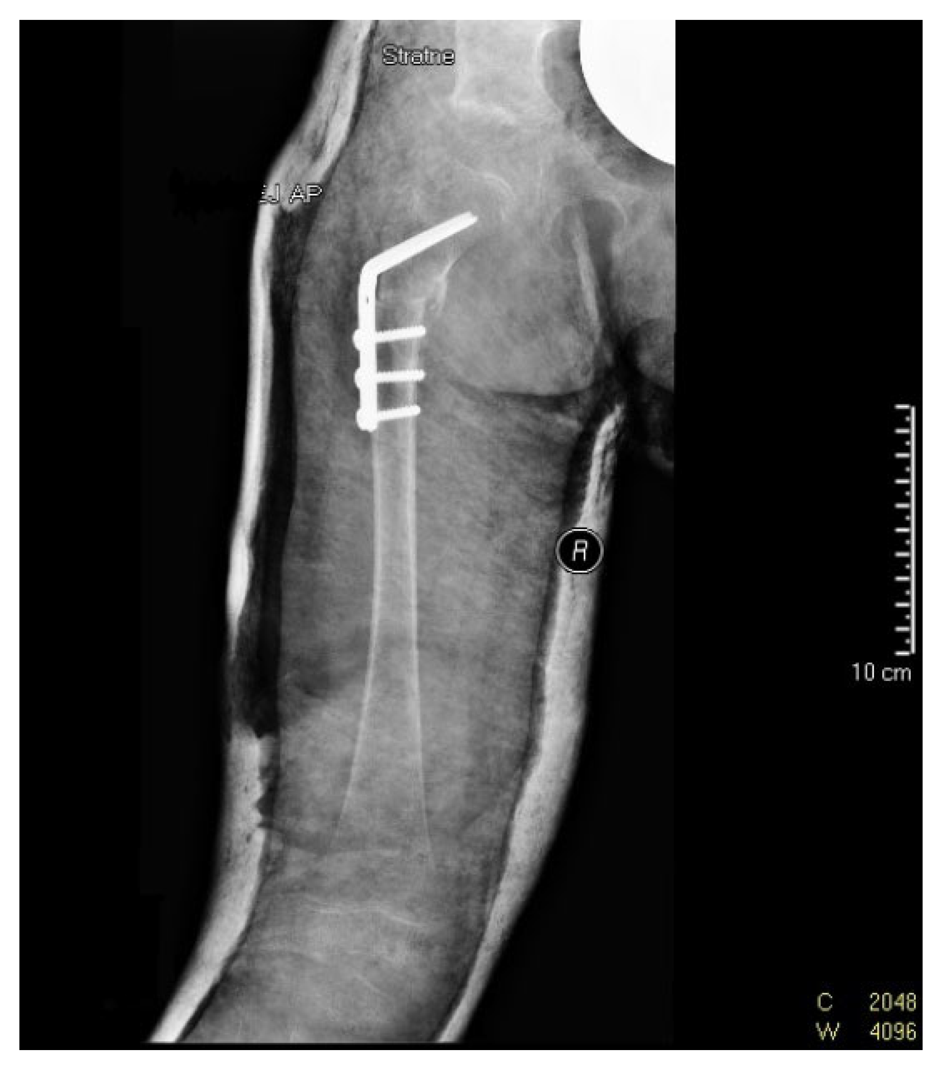 Diagnostics 12 01472 g005
