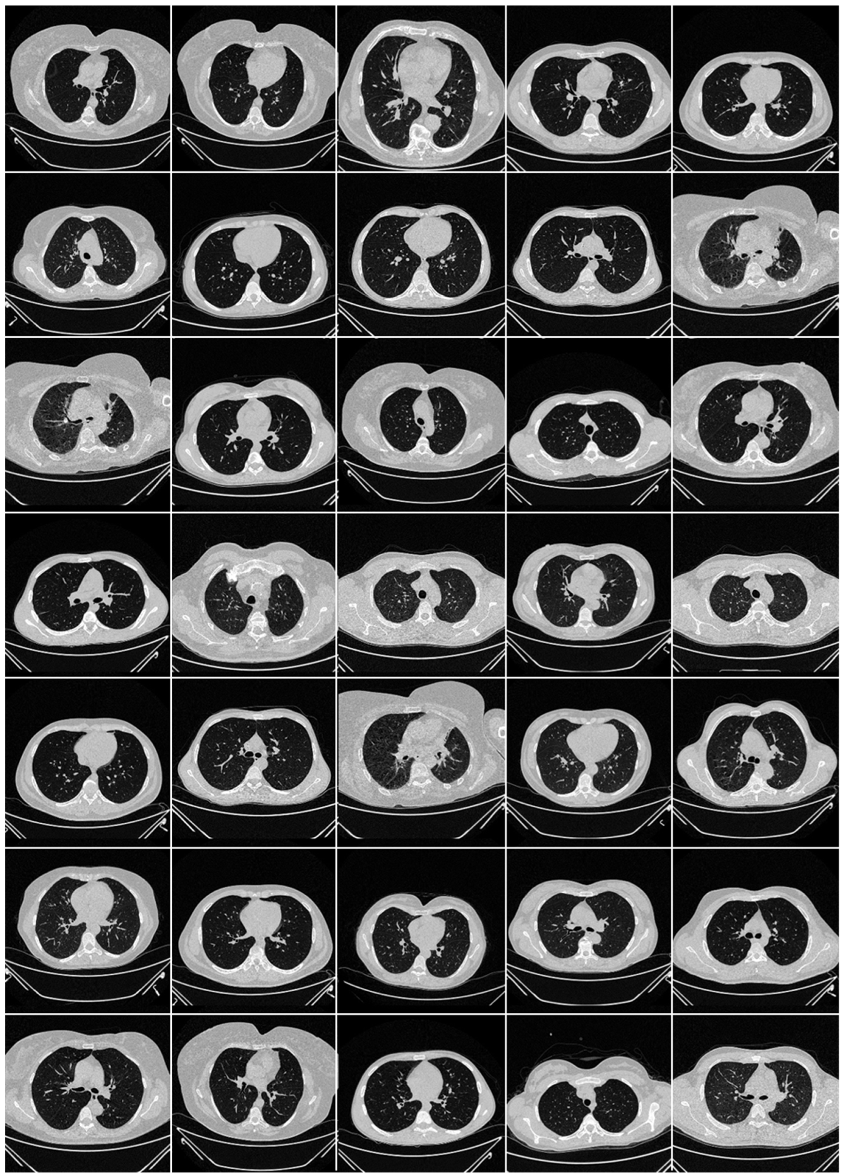 Diagnostics 12 01482 g003