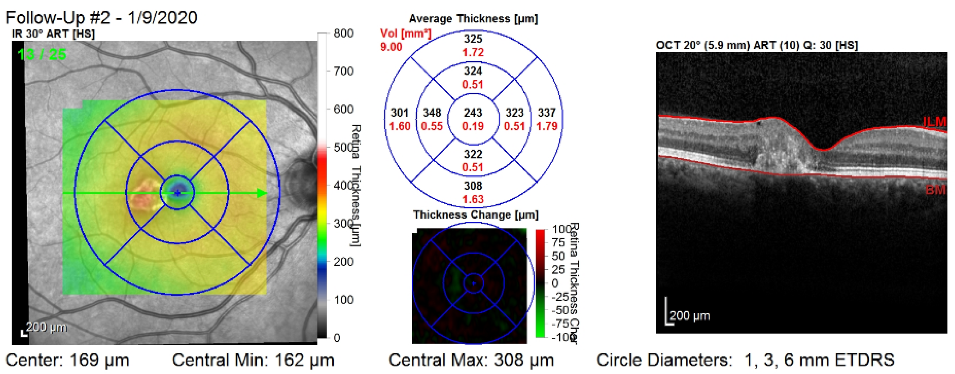 Diagnostics 12 01504 g001