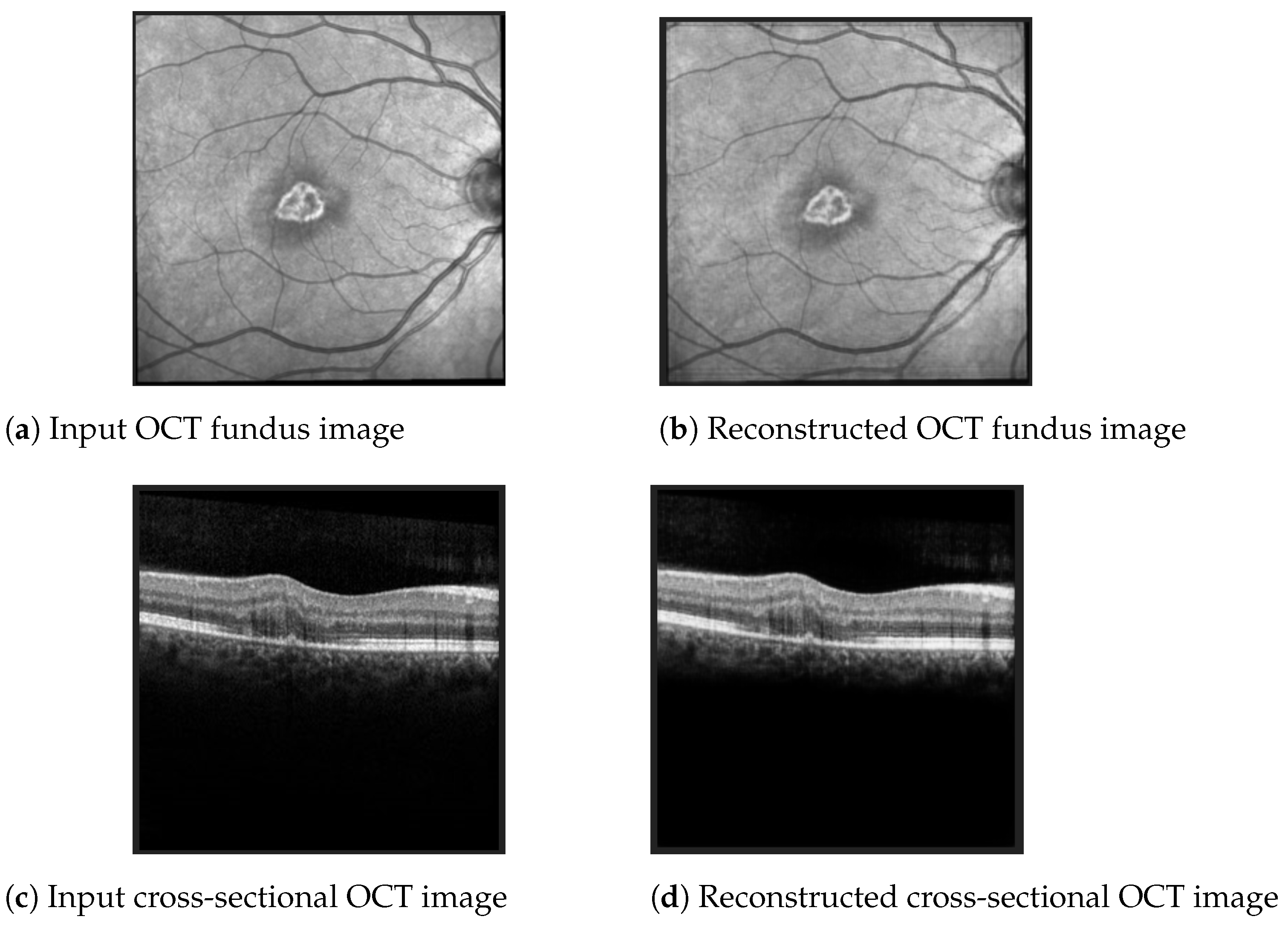 Diagnostics 12 01504 g008