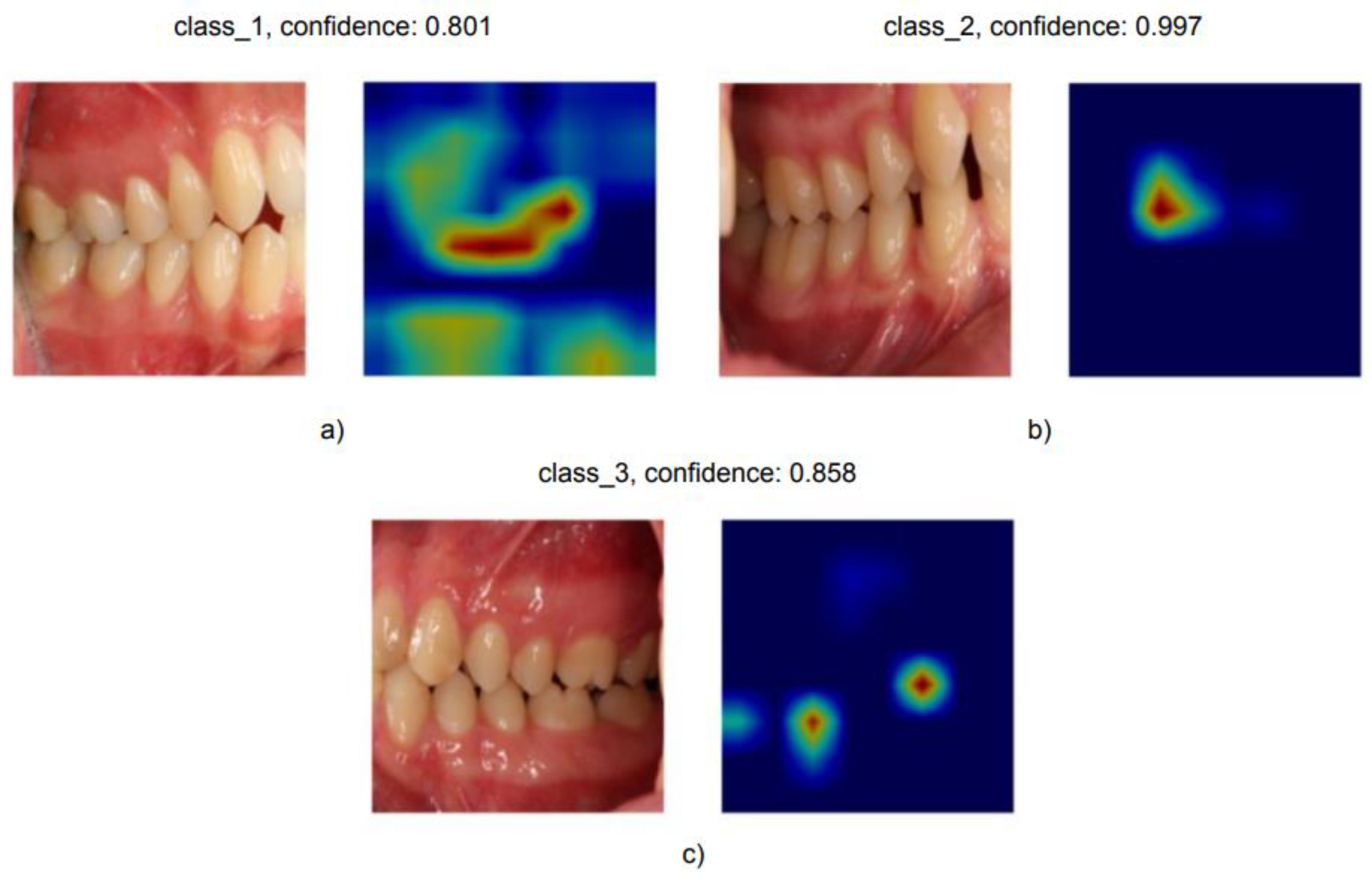 Diagnostics 12 01526 g007