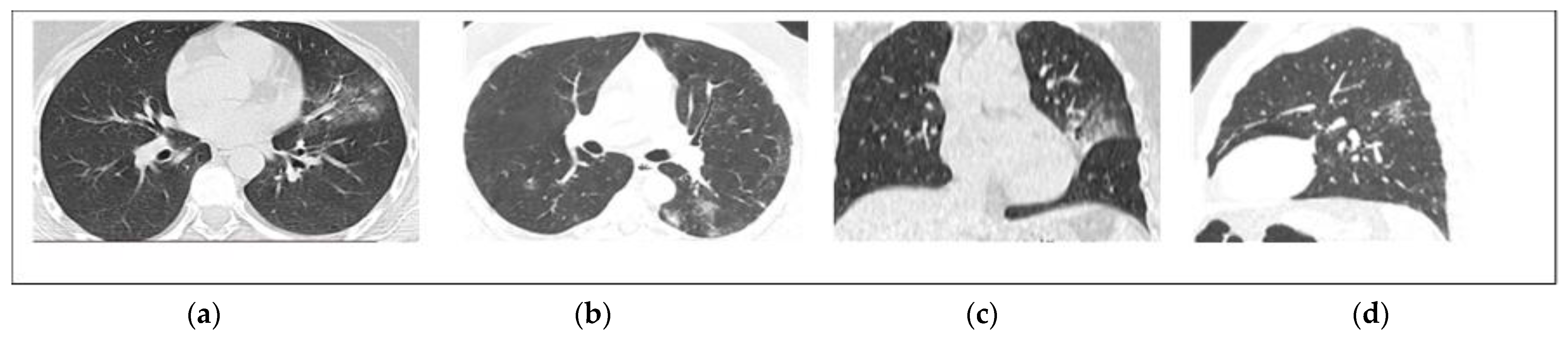 Diagnostics 12 01529 g002