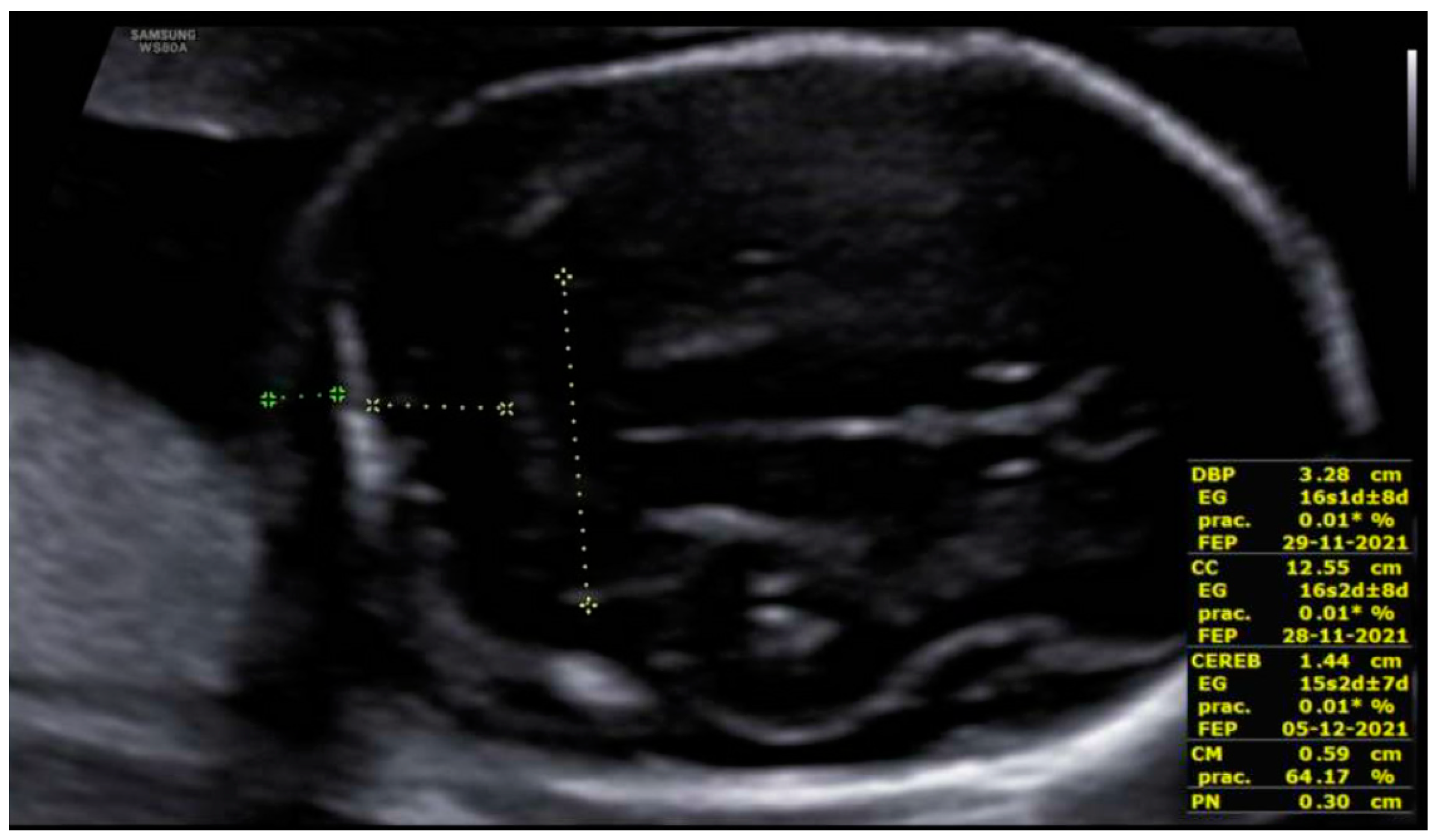 Diagnostics 12 01535 g004