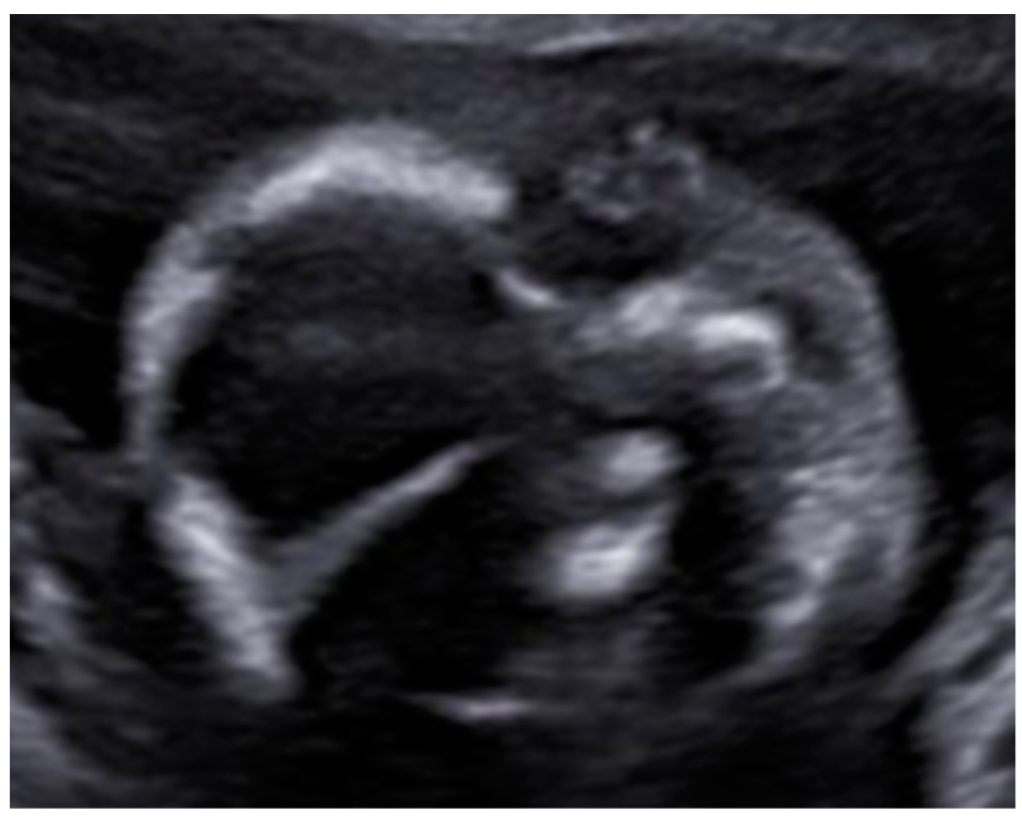 Diagnostics 12 01535 g006