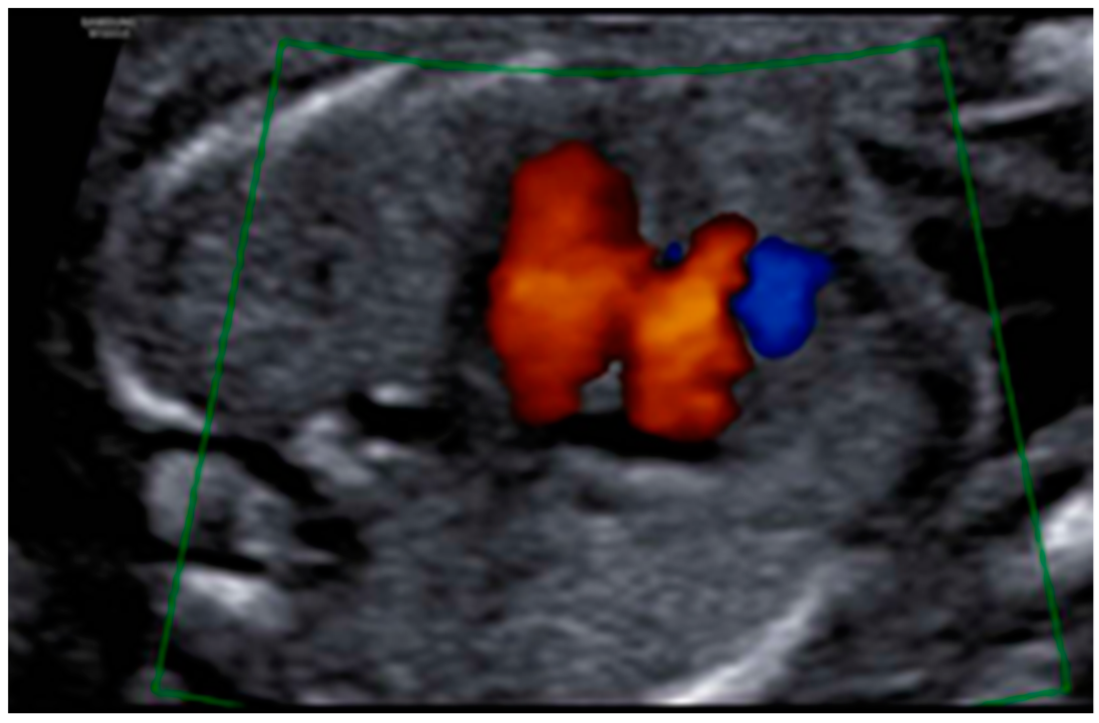 Diagnostics 12 01535 g007