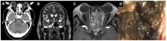 Diagnostics 12 01540 g001
