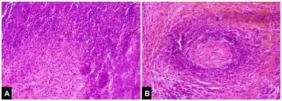 Diagnostics 12 01540 g002