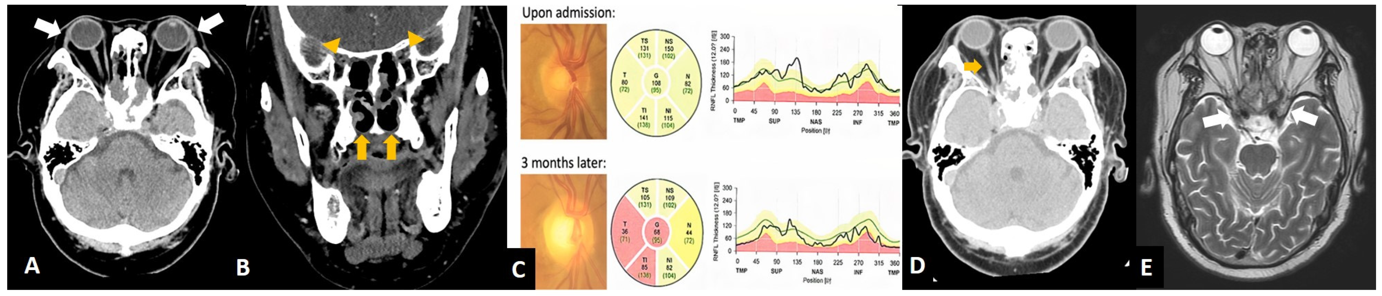 Diagnostics 12 01540 g003