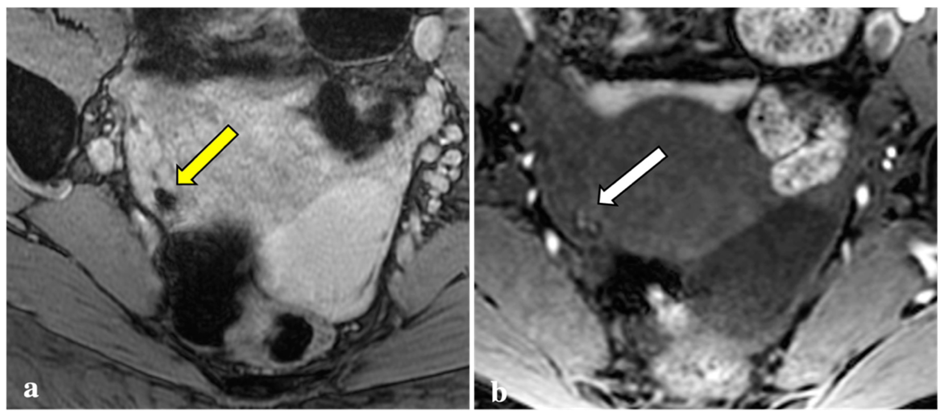 Diagnostics 12 01545 g003