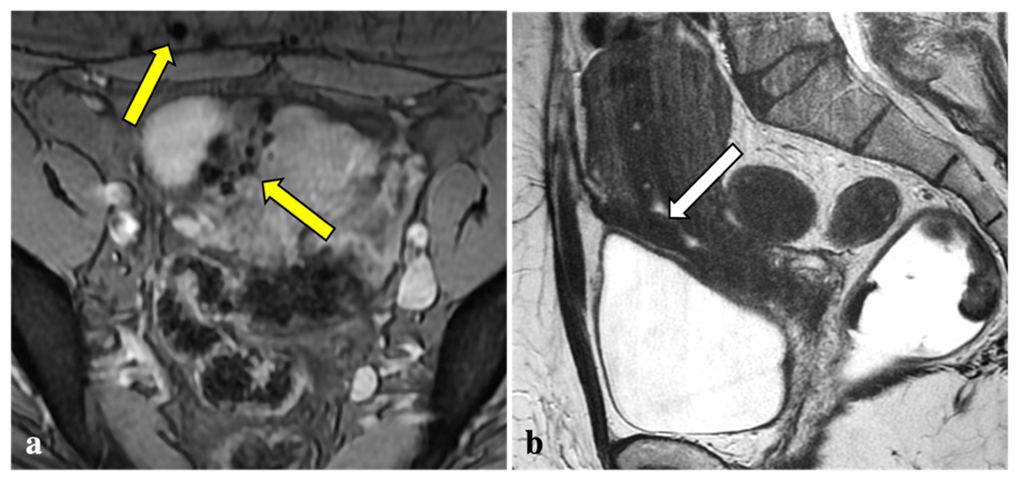 Diagnostics 12 01545 g004