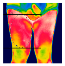 Diagnostics 12 01550 i015