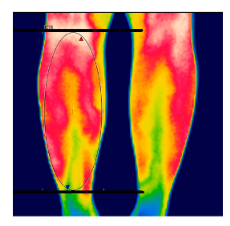 Diagnostics 12 01550 i018