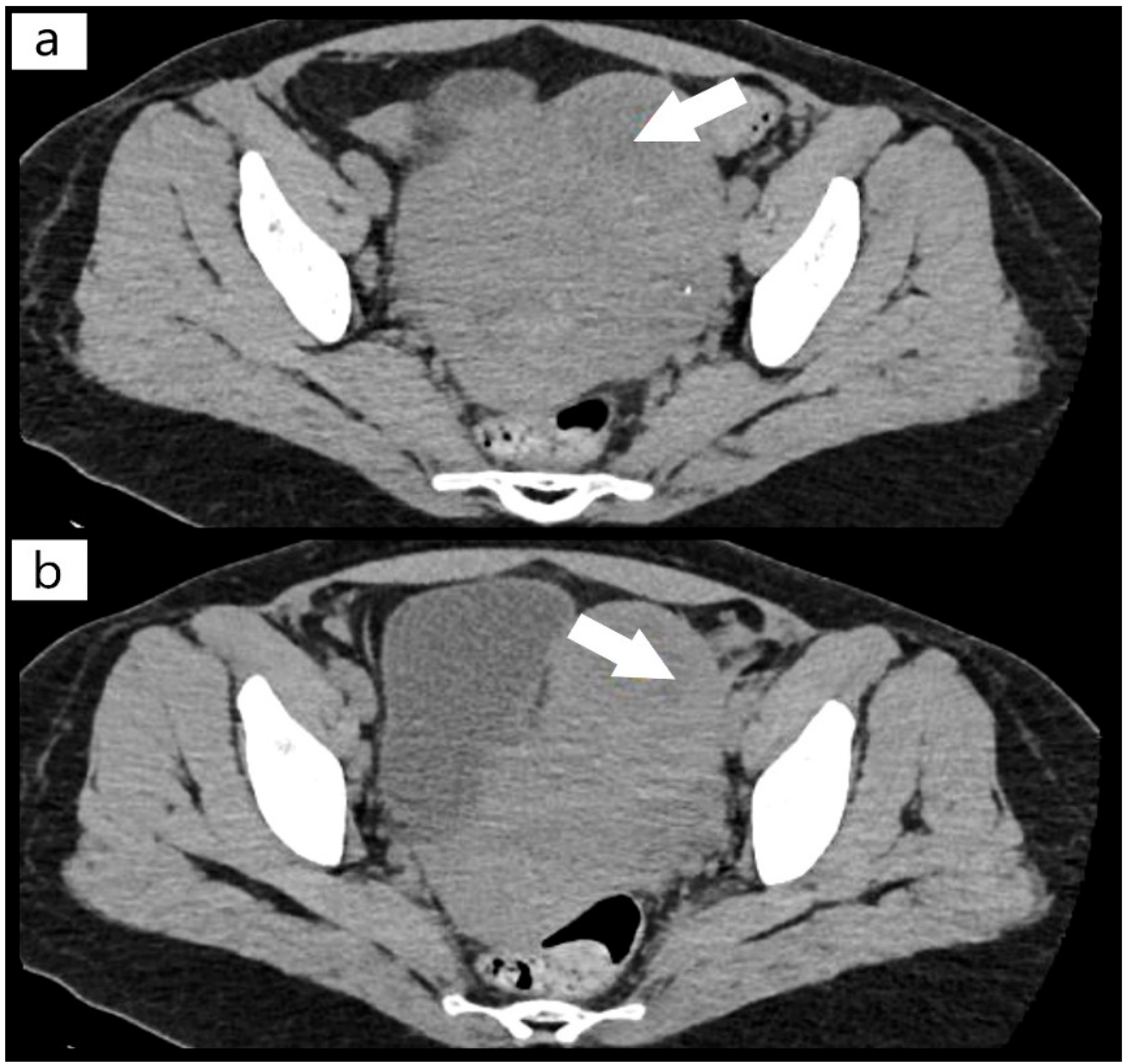 Diagnostics 12 01559 g001