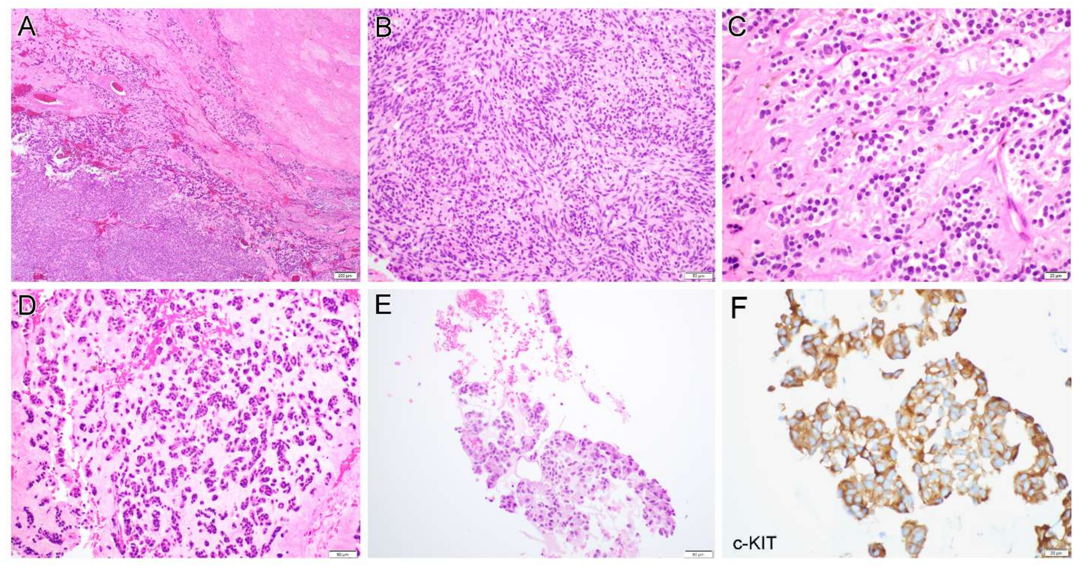 Diagnostics 12 01563 g004a Diagnostics 12 01563 g004a