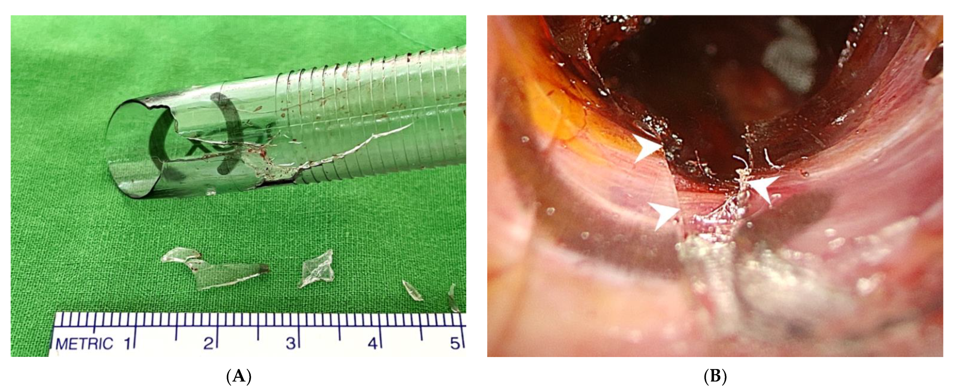 Diagnostics 12 01566 g003