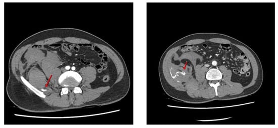 Diagnostics 12 01568 g001 550