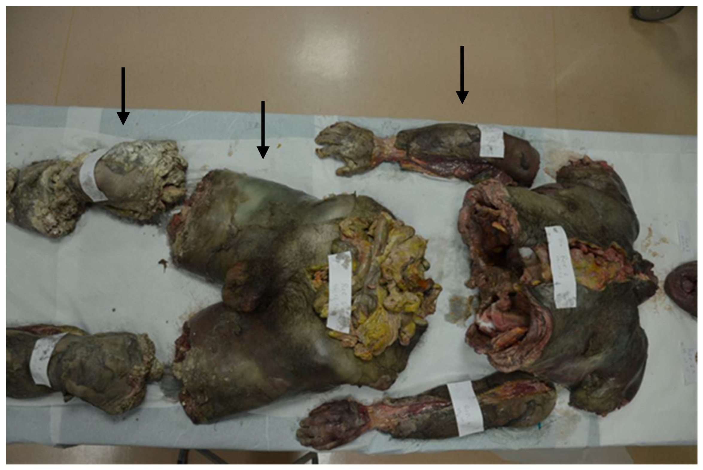 Diagnostics 12 01577 g001