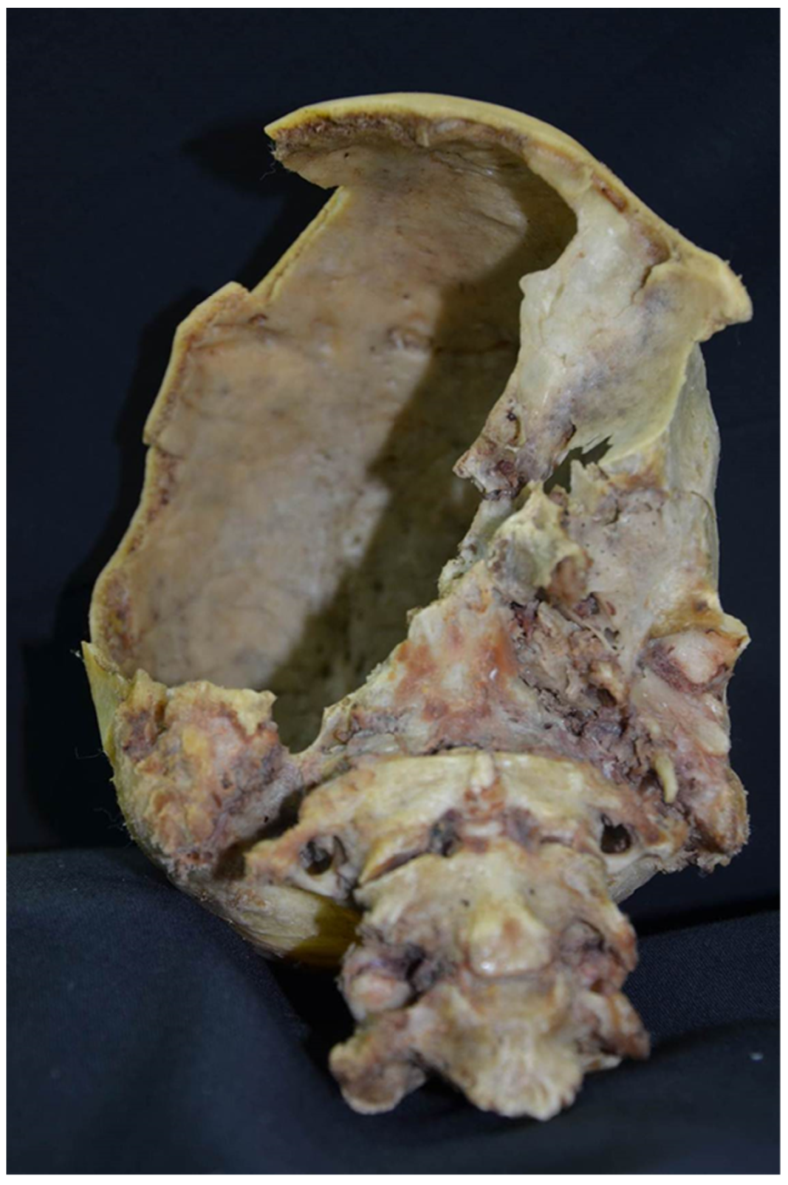 Diagnostics 12 01577 g003