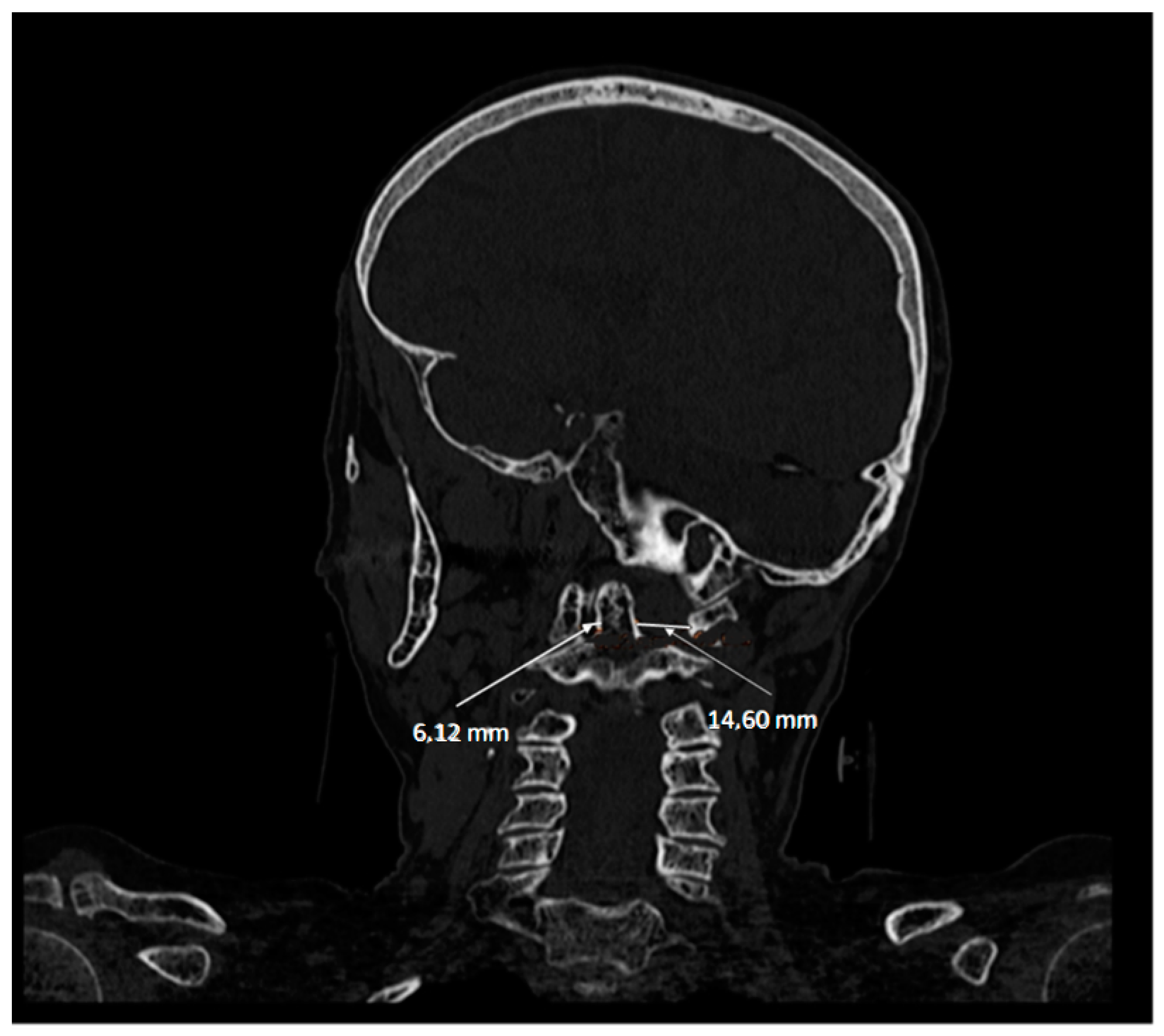 Diagnostics 12 01615 g004