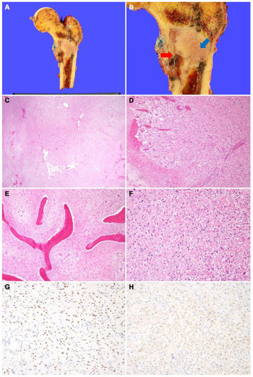 Diagnostics 12 01622 g002 550