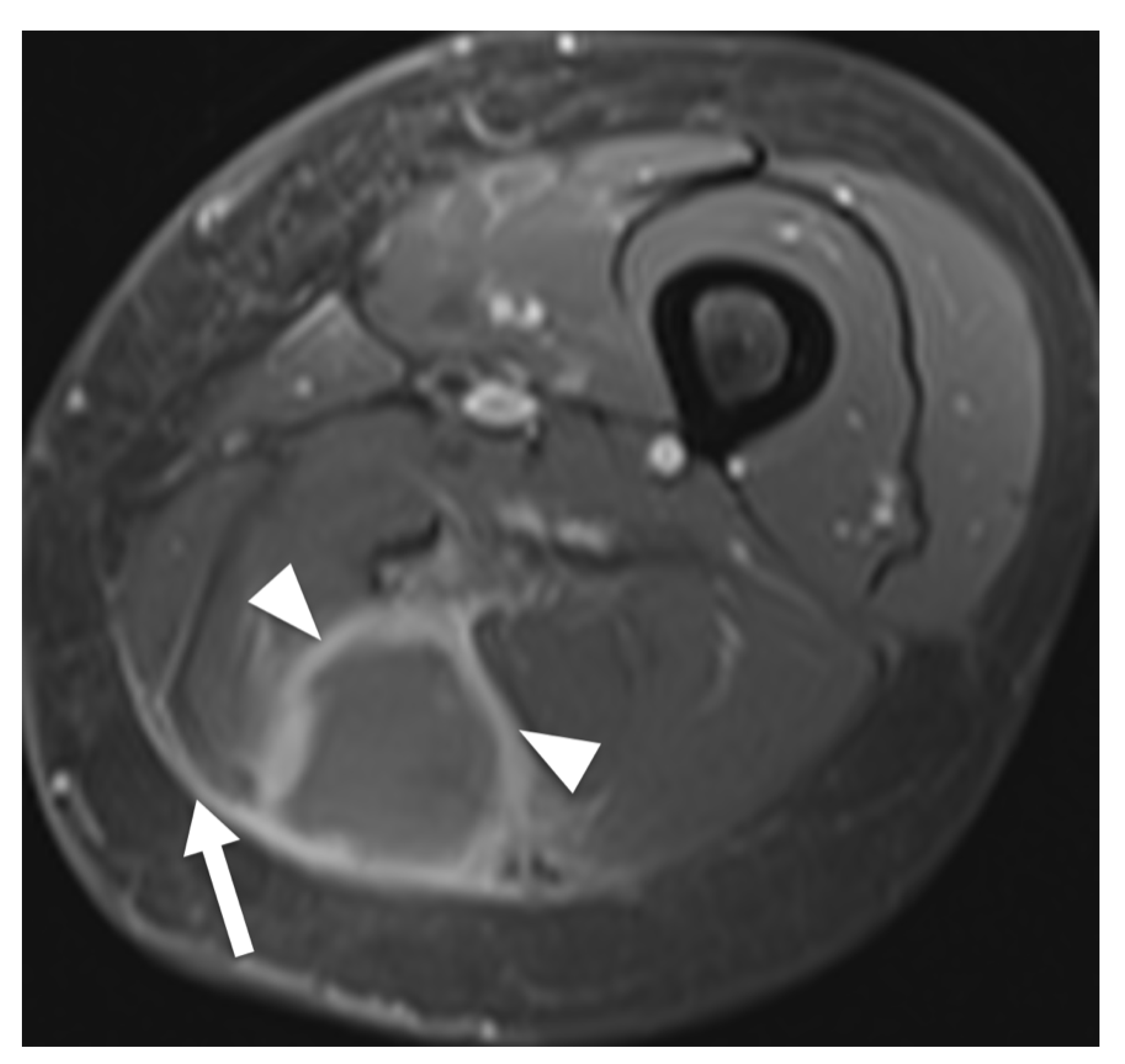Diagnostics 12 01623 g003
