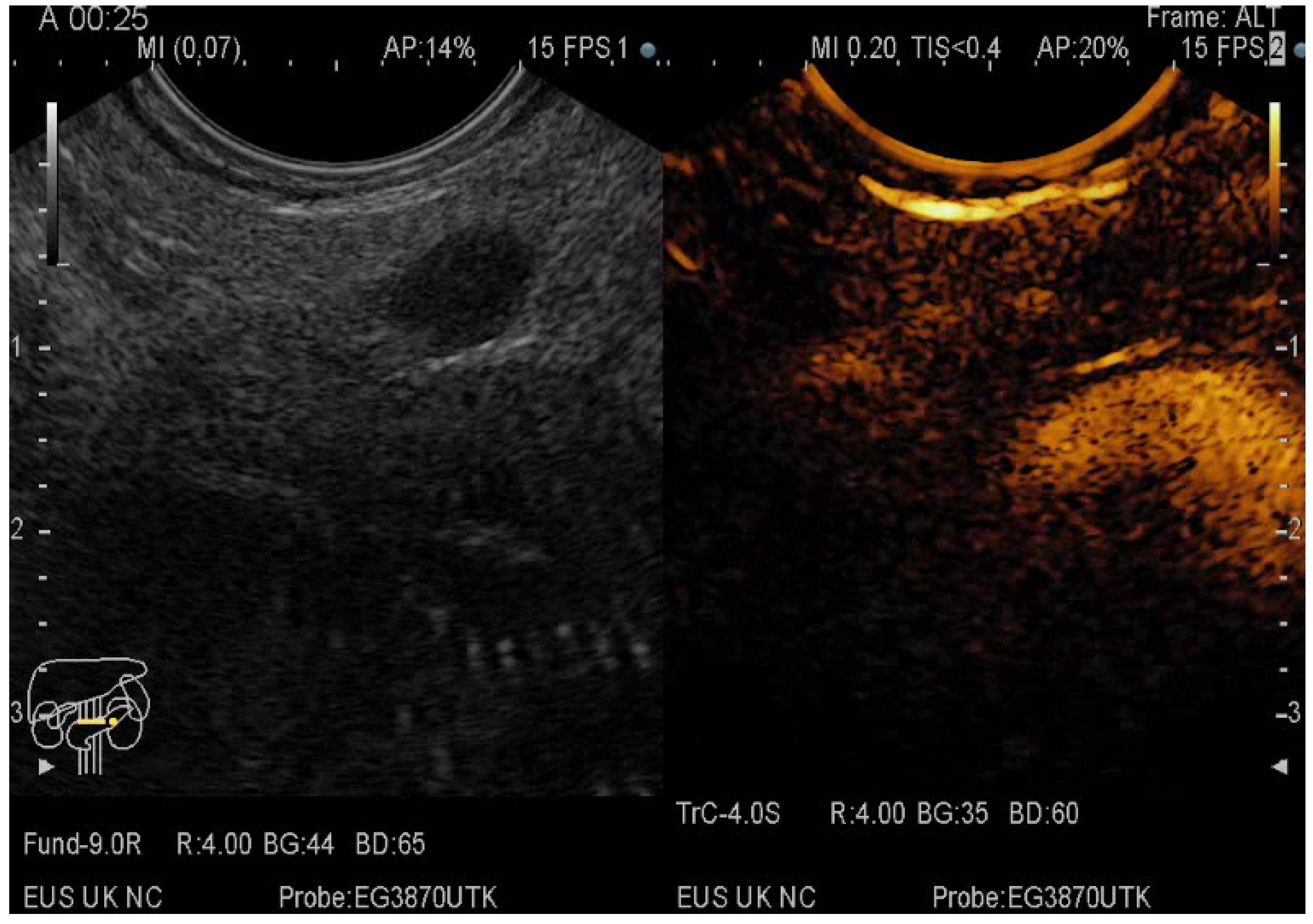Diagnostics 12 01641 g005