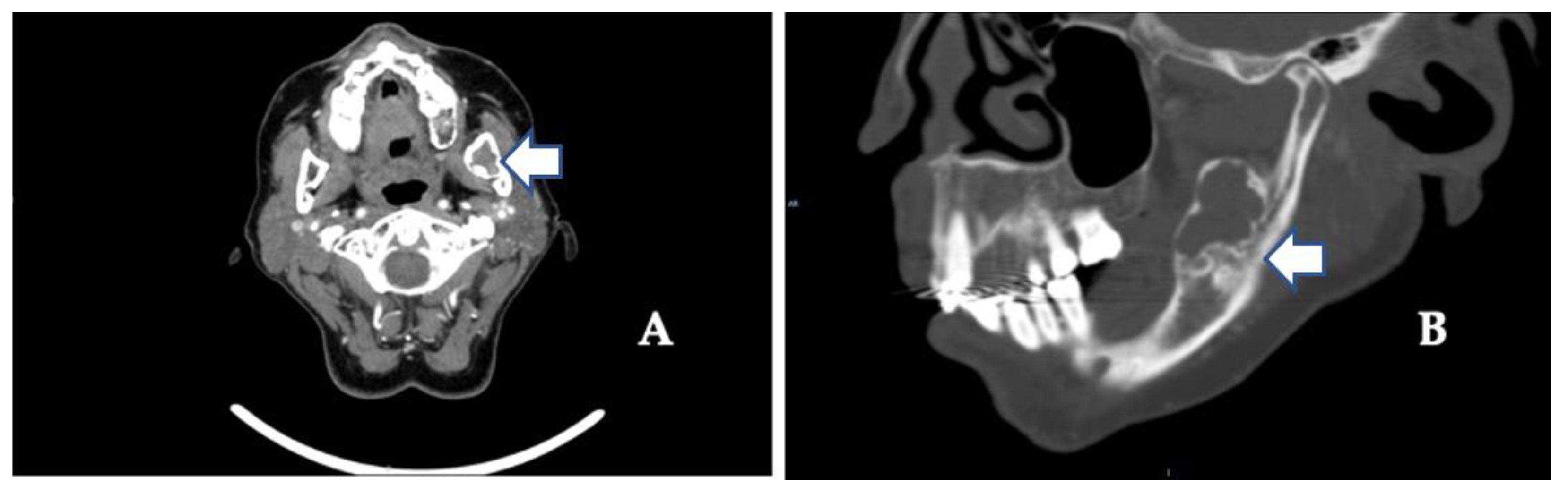 Diagnostics 12 01651 g002